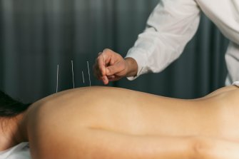 Acupuncteur Roanne